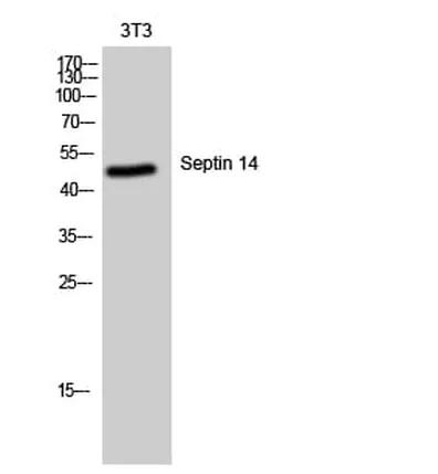 Antibodie to-SEPT14 