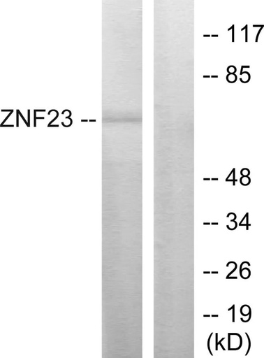 Antibodie to-ZNF23 