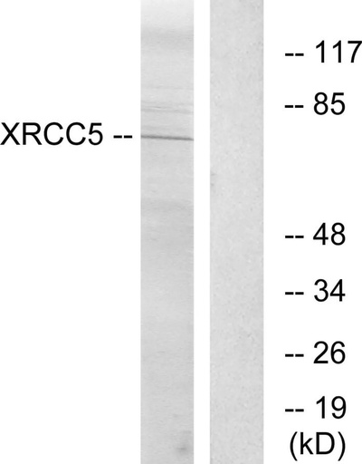 Antibodie to-XRCC5 