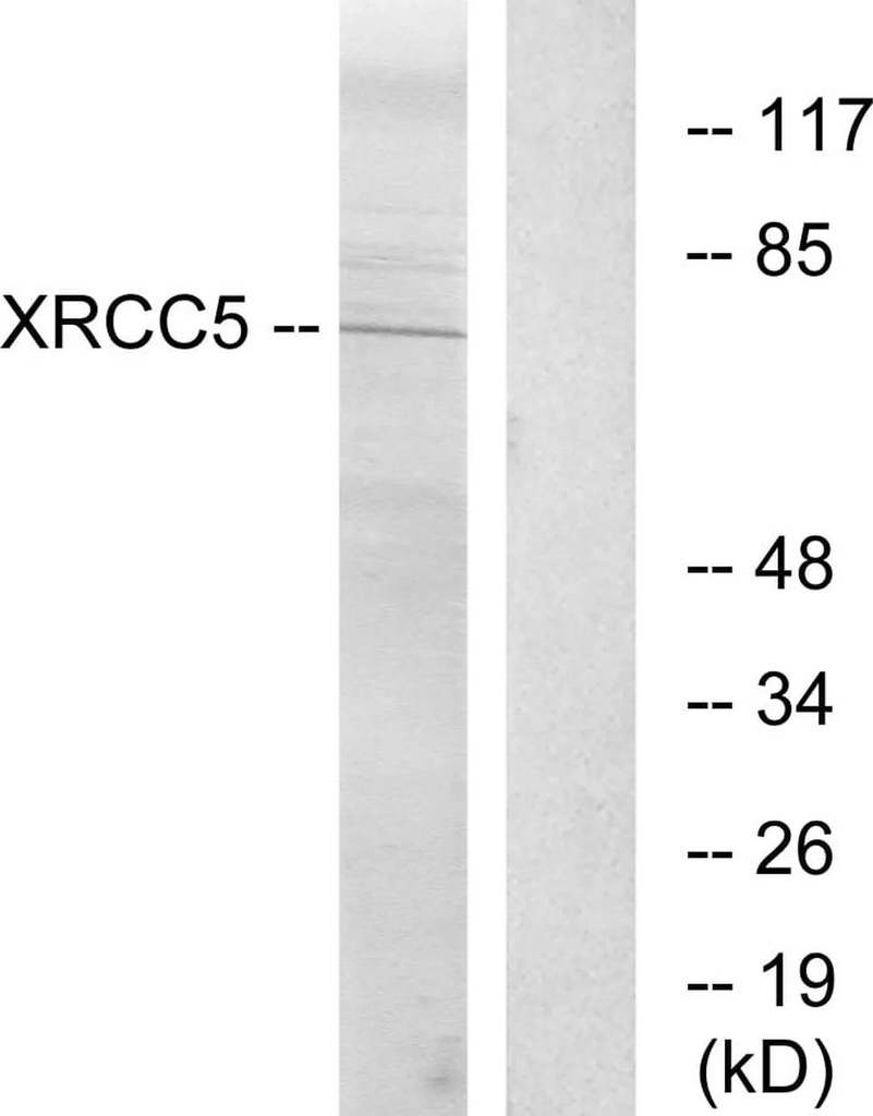 Antibodie to-XRCC5 