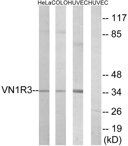 Antibodie to-VN1R3 