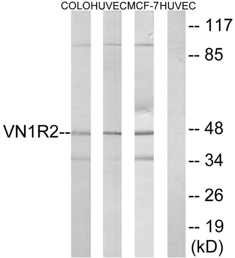 Antibodie to-VN1R2 