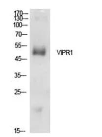 Antibodie to-VIPR1 