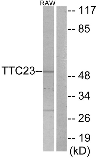 Antibodie to-TTC23 