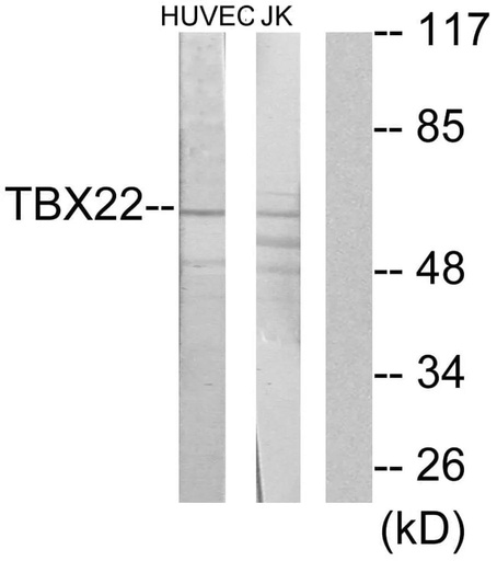 Antibodie to-TBX22 