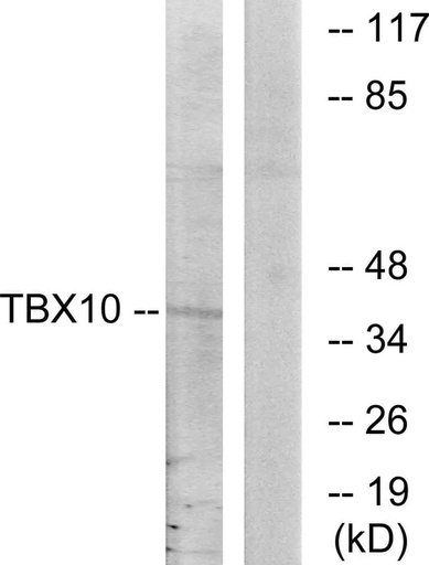 Antibodie to-TBX10 
