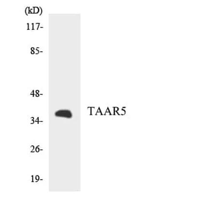Antibodie to-TAAR5 