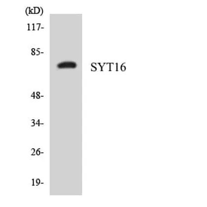 Antibodie to-SYT16 