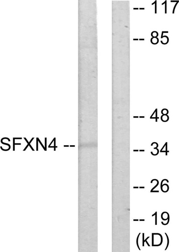 Antibodie to-SFXN4 
