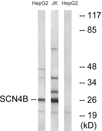 Antibodie to-SCN4B 