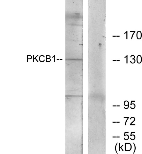Antibodie to-PKCB1 
