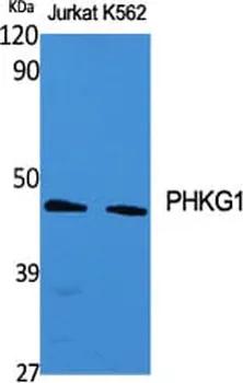 Antibodie to-PHKG1 