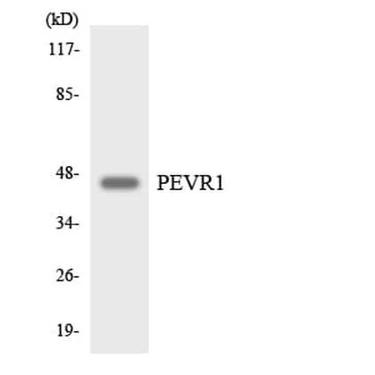 Antibodie to-PEVR1 