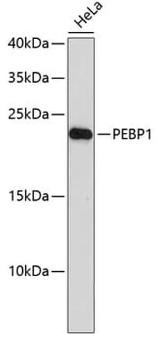 Antibodie to-PEBP1 