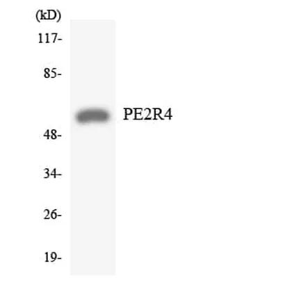 Antibodie to-PE2R4 