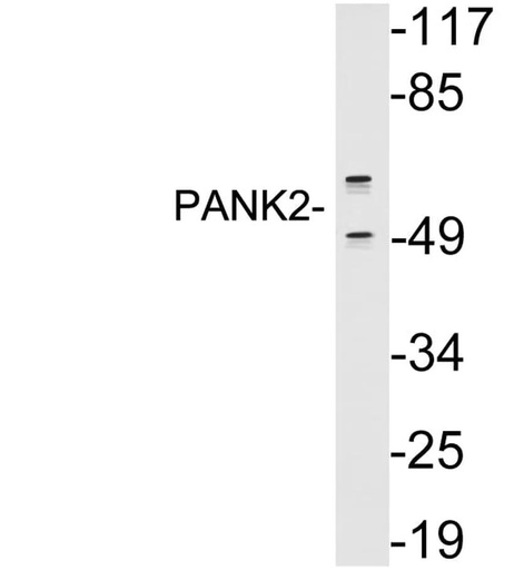Antibodie to-PANK2 