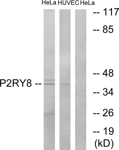 Antibodie to-P2RY8 