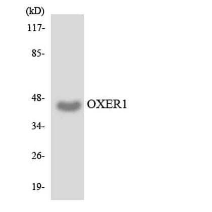 Antibodie to-OXER1 