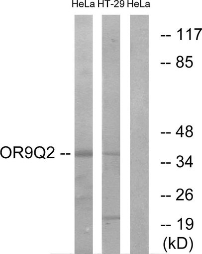 Antibodie to-OR9Q2 