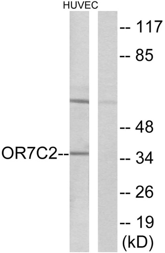 Antibodie to-OR7C2 