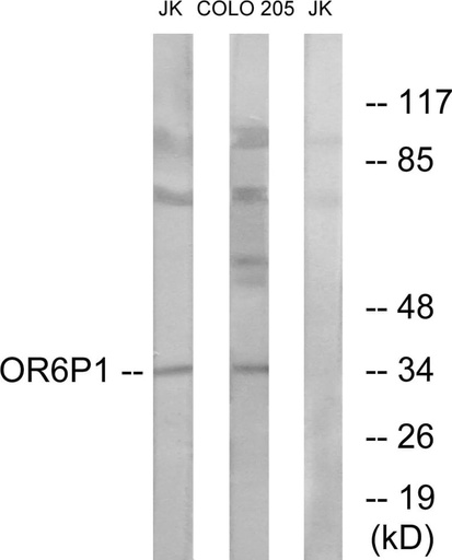 Antibodie to-OR6P1 