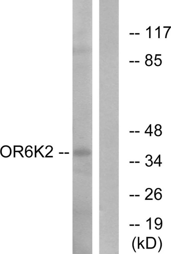 Antibodie to-OR6K2 