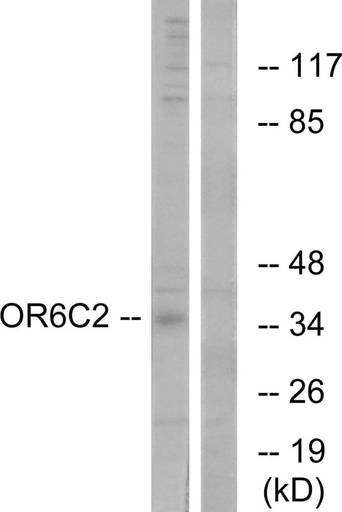 Antibodie to-OR6C2 