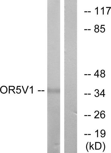 Antibodie to-OR5V1 