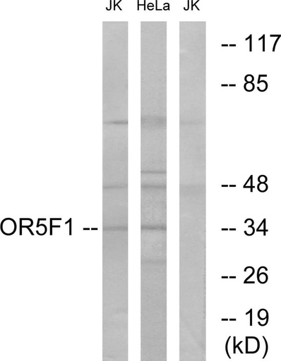 Antibodie to-OR5F1 
