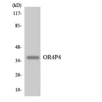 Antibodie to-OR4P4 