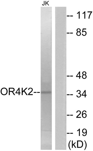 Antibodie to-OR4K2 