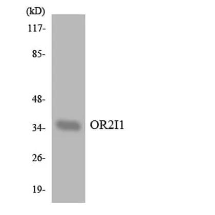 Antibodie to-OR2I1 