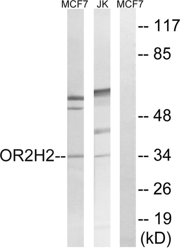Antibodie to-OR2H2 