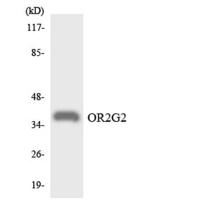 Antibodie to-OR2G2 