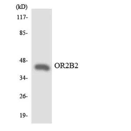 Antibodie to-OR2B2 
