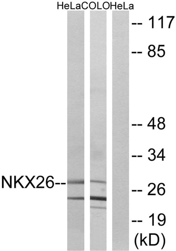 Antibodie to-NKX26 