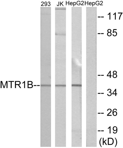 Antibodie to-MTR1B 