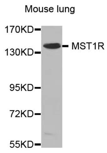 Antibodie to-MST1R 