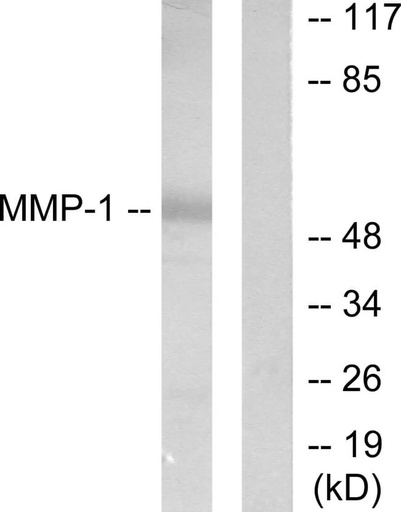 Antibodie to-MMP-1 