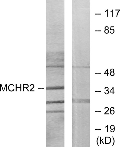 Antibodie to-MCHR2 