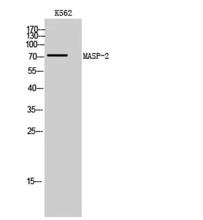 Antibodie to-MASP2 