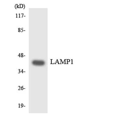 Antibodie to-LAMP1 