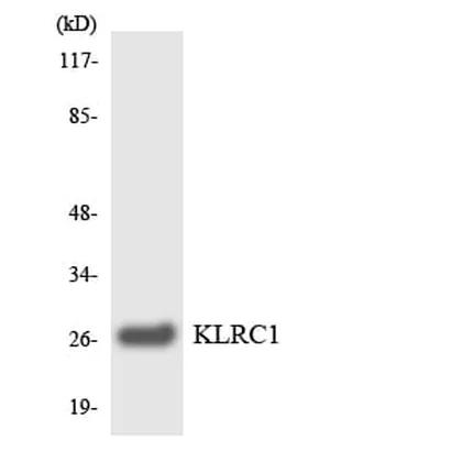 Antibodie to-KLRC1 
