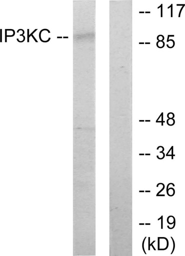 Antibodie to-IP3KC 