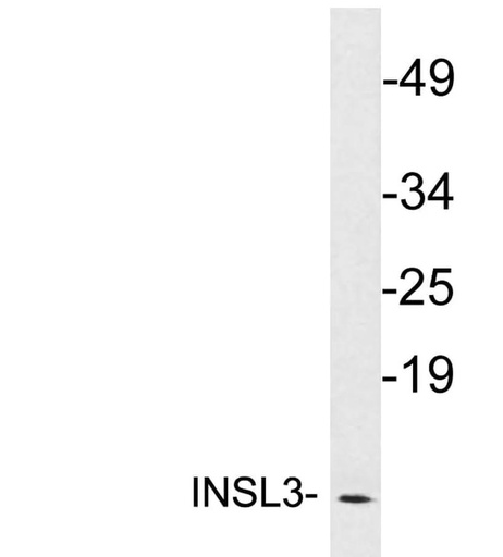Antibodie to-INSL3 