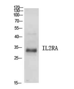 Antibodie to-IL2RA 