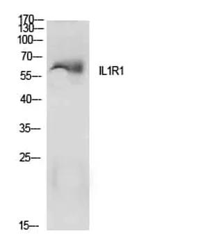 Antibodie to-IL1R1 