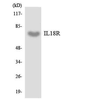 Antibodie to-IL18R 