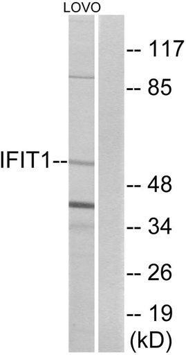Antibodie to-IFIT1 