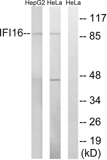 Antibodie to-IFI16 